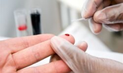 اختلال در تنظیم قند خون می تواند تمام ارگان های بدن را درگیر کند