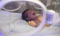 مراقبت‌های مستمر پس از ترخیص کلید سلامت پایدار نوزادان نارس