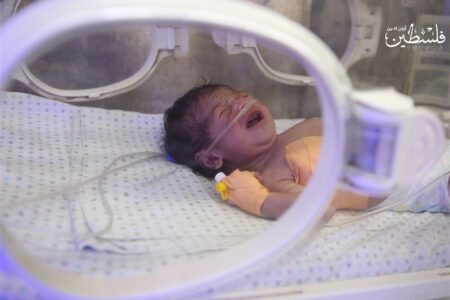 مراقبت‌های مستمر پس از ترخیص کلید سلامت پایدار نوزادان نارس