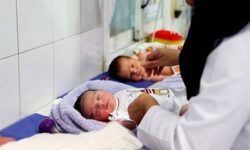 کاهش مرگ مادران باردار در لرستان/  جذب 10درصد متخصصان بیهوشی کشور